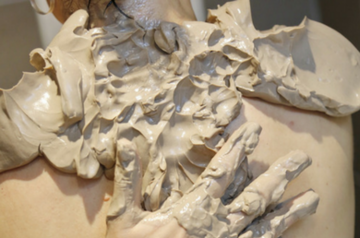 soin cure thermale rhumatologie - application de boue